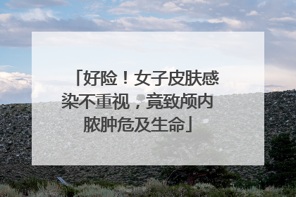 好险！女子皮肤感染不重视，竟致颅内脓肿危及生命